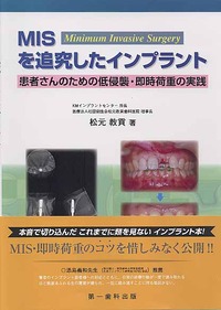 ＭＩＳを追究したインプラント